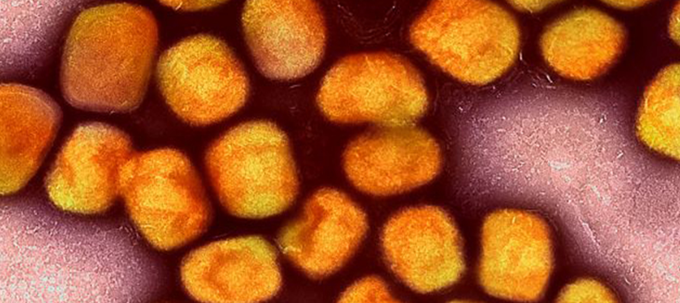 Up close view of Monkeypox Virus