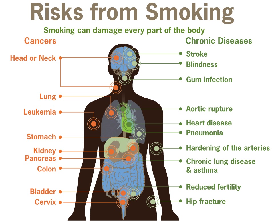 health risks associated with smoking tobacco